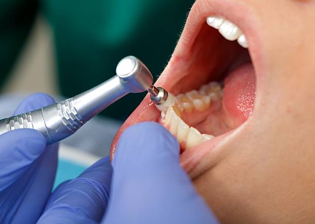 Laser Dentistry in Woodworth, LA